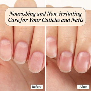 <span class=keywords><strong>Aceite</strong></span> Reparador <span class=keywords><strong>de</strong></span> Uñas con Vitamina E Orgánica al por Mayor para el Crecimiento y Fortalecimiento Natural <span class=keywords><strong>de</strong></span> las Uñas - Product Image 6