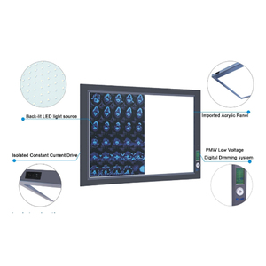 เครื่องดูฟิล์มทางการแพทย์ LED สองชั้นแบบบางพิเศษควบคุมด้วยระบบดิจิทัลเต็มรูปแบบ