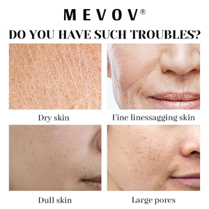 <span class=keywords><strong>Crema</strong></span> <span class=keywords><strong>Calendula</strong></span> marchio privato <span class=keywords><strong>lenitiva</strong></span> schiarente idratante soluzione nutritiva per la pelle secca <span class=keywords><strong>crema</strong></span> per il viso - Product Image 5