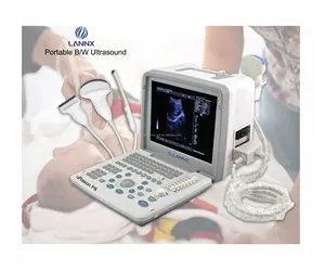 LANNX uRason P8新しい本物のポータブル超音波診断機器病院機器産卵超音波デバイス