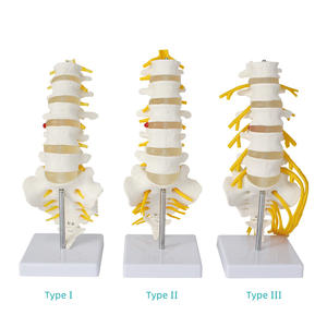 Modello di Vertebre Lombari a 5 Segmenti a Grandezza Naturale con Nervo Sacrale, Sacro Apribile, Dotato di Nervo Caudale Equino - Product Image 1