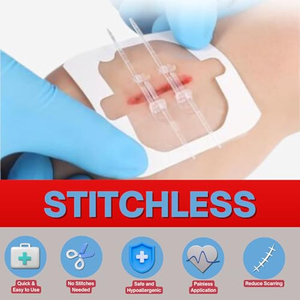 Cierre de heridas con cremallera médica Zip Stitch, marca privada, para ataduras, dispositivo de emergencia, 2 unidades, suturas, tira de cierre de heridas - Product Image 6