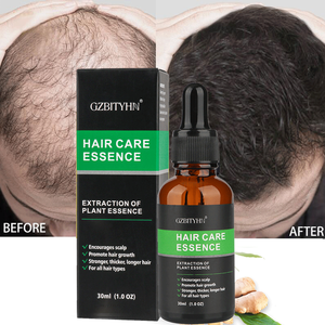 Aceite de Suero para el Crecimiento del Cabello Orgánico, Promueve la Salud del Cuero Cabelludo, Cuidado de la Piel, 30 ml, Aceite Capilar de Marca Privada, Ingredientes Herbales de Ginseng 100% - Product Image 5