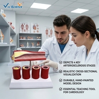 Modelo Comparativo de Vasos Coronarios para Aterosclerosis y Trombosis, para Entrenamiento de Anatomía Médica, con Certificaciones CE/ISO/ROHS/CNAS