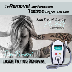 Haute qualité Nd-Yag Q-Switch <span class=keywords><strong>Laser</strong></span> nouvelle 1064Nm longue impulsion Premium Machine de dé<span class=keywords><strong>tatouage</strong></span> pour le coût de dé<span class=keywords><strong>tatouage</strong></span> de la peau - Product Image 2