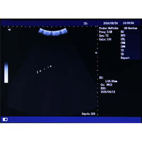Escáner de Ultrasonido Veterinario para Animales, Máquinas de Ultrasonido para Perros, Escáner de Ultrasonido para Examen de Gestación Animal