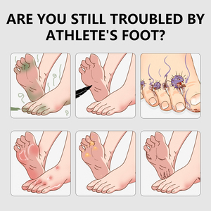 तियन लूओ शान लोकप्रिय उत्पाद दर्द और खुजली राहत प्राकृतिक हर्बल एंटीबैक्टीरियल डिओडोनाइजिंग पैर देखभाल स्प्रे - Product Image 3