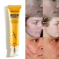 Crème-Pommade Réparatrice de Cicatrices Marque Blanche, Éclaircissante pour le Visage, contre les Marques d'Acné et les Cicatrices, Enrichie au Rétinol et à l'Acide Kojique