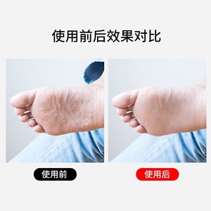 Lima para pies, limpiador de pies de acero inoxidable, piedra para recortar y exfoliar los pies, herramienta para frotar los pies y eliminar la piel muerta - Product Image 3