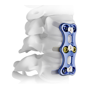 Revestimientos de Titanio Ti-6Al-4V ELI Desplazados y Lateralizados para Biomecánica de Cadera - Product Image 2