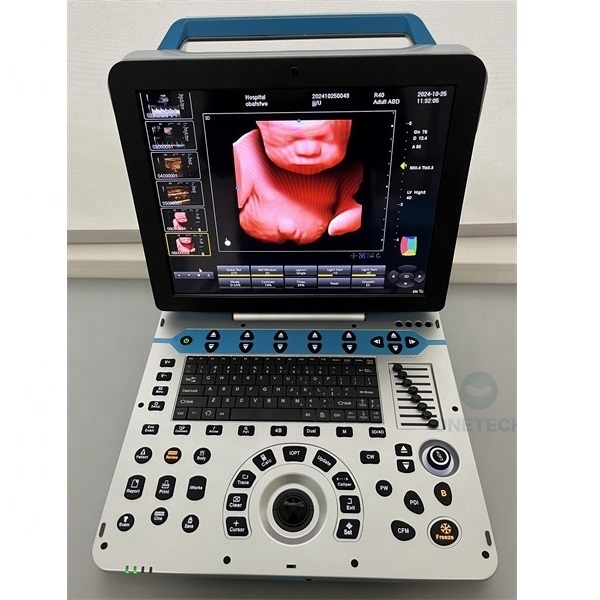 C57 Ultrasound Instruments 5D Full Digital Desktop Color Doppler 4D Ultrasound Machine