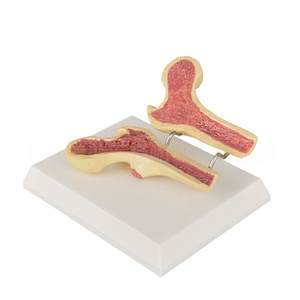Modèle de fémur ostéoporotique-Comparaison de la densité osseuse transversale pour l'enseignement orthopédique et l'éducation gériatique - Product Image 2