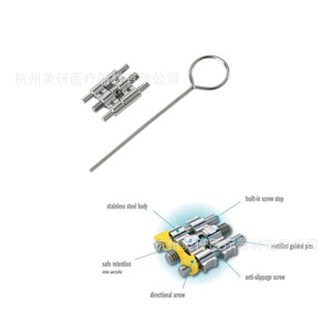 อุปกรณ์ขยายฟันแบบแมนนวล Alice Fixed Arch Expander ทำจากสแตนเลส - Product Image 3