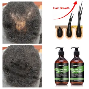 Mankani 300ml Botol Perawatan Rambut <span class=keywords><strong>Herbal</strong></span> Organik Sehat, Sampo dan Kondisioner Pengontrol Minyak, Perawatan Rambut Rontok dengan Jahe yang Menebalkan - Product Image 5