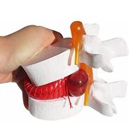 Ayuda para enseñanza biológica, anómicas vértebras lumbares, humanos, degenerativas, modelo de columna vertebral, Color blanco