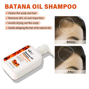 Divine Vitals Aceite De Batana Y Romero Donde Comprar Shampooing De Batana Para <span class=keywords><strong>Que</strong></span> Sirve Aceite Botanic Batana Oil Honduras - Product Image 3