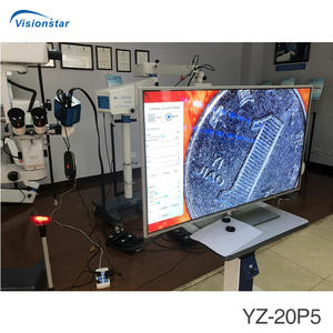 <span class=keywords><strong>YZ20P5</strong></span>中国眼科デバイスサプライヤー眼科手術顕微鏡 - Product Image 5