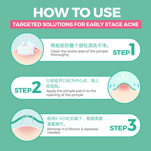 カスタムロゴ入り韓国産サリチル酸ハイドロコロイドニキビパッチステッカー、顔用ニキビパッチ - Product Image 5