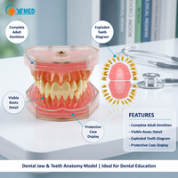 Modèle d'étude d'implant dentaire avec dents amovibles – Modèle standard pour l'enseignement médical (CE/ISO)