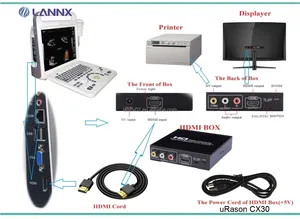 LANNX uRason CX30 Ordinateur portable personnalisé Cardiologie numérique Machine à ultrasons Scanner à ultrasons Doppler couleur ecografo portatil