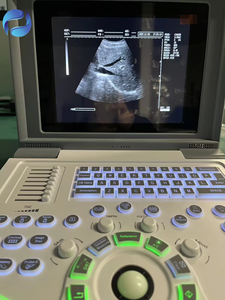 Échographe portable électrique pour grossesse, type ordinateur portable, pour cliniques, instruments d'échographie médicale avec garantie de <span class=keywords><strong>3</strong></span> ans - Product Image 6