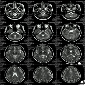 Deshiwei ฟิล์มทางการแพทย์เลเซอร์สีขาว <span class=keywords><strong>A3</strong></span>ในแผ่นฟิล์มทางการแพทย์ผลิตใน Henan สำหรับคลินิกโรงพยาบาล - Product Image 2