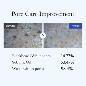 Masque Facial Purifiant au Charbon Actif Anti-Points Noirs Formule Rafraîchissante et Resserre les Pores Soin Visage à l'Argile 100g Marque Blanche - Product Image 5