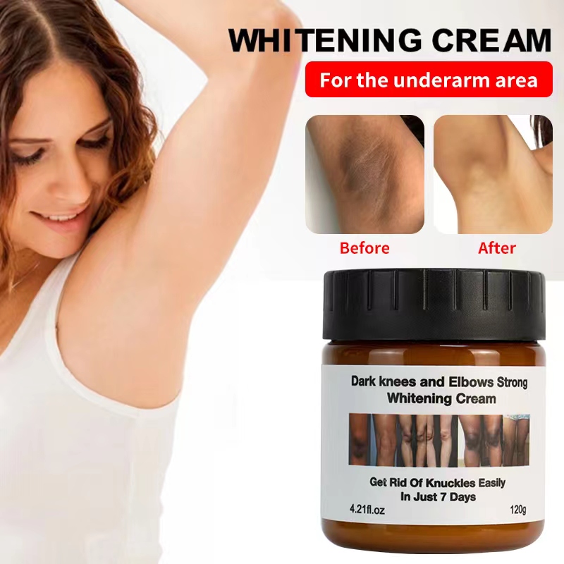 Private Label Extreme White ning Anti Dark Spot Schlagsahne Aufhellende Knie Ellbogen Starke Vitamin Lotion Gesichts körper creme