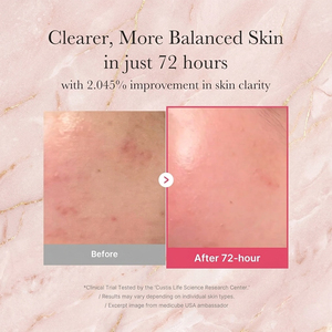 Precio de Fábrica para Suero Facial Coreano 30mL Vitamina C Antiarrugas Hidratante para Mujeres - Product Image 4
