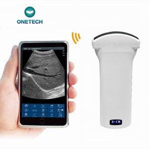 Sonda de Ultrasonido Convexa Portátil C38B con Certificación CE R60 192E de 3.5 y 5 MHz, <span class=keywords><strong>Doppler</strong></span> Color, Veterinaria/Humana, para Abdomen - Product Image 1