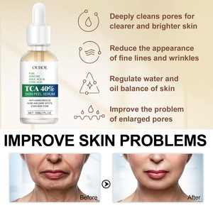 Siero Antirughe al Collagene, Effetto Lifting e Rassodante, Riparatore di Linee Sottili, Essenza <span class=keywords><strong>Viso</strong></span> Levigante, Cura della Pelle Anti-Età - Product Image 5