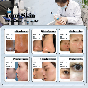 Hot bán tần số cao 14 trong <span class=keywords><strong>1</strong></span> Hydra da mặt máy - Product Image 2