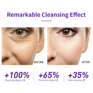 LANBENA Nouveautés Mousse Nettoyante Douce Bio Raffermissante Anti-Âge Anti-Rides Renouvelante pour Tous Types de Peau - Product Image 5