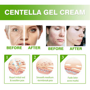 Moisturizing Natural Face <b>Serum</b> Bright <b>Skin</b> <b>Care</b> Whitening Moisturizer Pimples Dark Black Spot Remover - Product Image 4