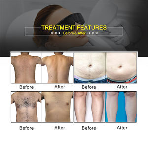 Meilleur appareil d'épilation au <span class=keywords><strong>laser</strong></span> portable pour salon Hommes Sans douleur 10 barres <span class=keywords><strong>laser</strong></span> <span class=keywords><strong>Épilateur</strong></span> - Product Image 5