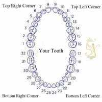 Grillz personnalisé en argent 925 avec moissanite VVS, style hip-hop, bijoux fins pour hommes, grillz en moissanite glacé pour les dents