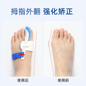 Attelle de Correction d'Orteils en PVC Blanc à Réglage Manuel, Dispositif de Soin des Pieds pour la Fixation du Hallux Valgus - Product Image 3