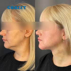 Láser de Diodo GOMECY para Lipólisis y Liposucción, Endoláser de Diodo de 980nm y 1470nm - Product Image 4