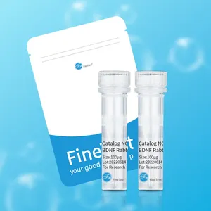 FineTest Asprosin Anticuerpo Probado Aplicación en ELISA IHC WB - Product Image 1