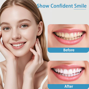 Nettoyage en profondeur des dents Polisseur <span class=keywords><strong>dentaire</strong></span> Dentifrice <span class=keywords><strong>professionnel</strong></span> inclus <span class=keywords><strong>Meilleur</strong></span> <span class=keywords><strong>kit</strong></span> de <span class=keywords><strong>blanchiment</strong></span> des dents - Product Image 4