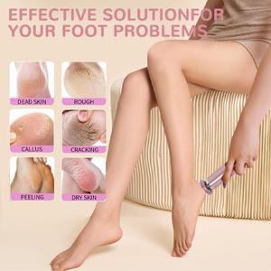 Nuevo Exfoliador Eléctrico 2 en 1 para Pies, Máquina Automática para Pedicura, Recorte de Piel y Eliminación de Piel Muerta, Lima Eléctrica para Pies - Product Image 4