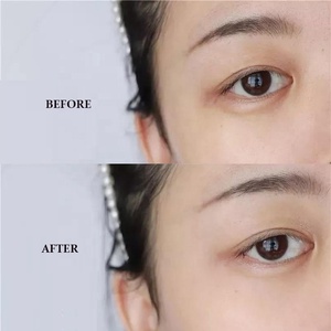 Crema blanqueadora de retinol orgánico, espinillas y removedor de manchas oscuras, Juego completo para pieles oscuras - Product Image 5