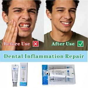 <span class=keywords><strong>Dentifricio</strong></span> alle Erbe Jianmin <span class=keywords><strong>Sensodyne</strong></span> 100g per Denti Sensibili, Sollievo Rapido da Sensibilità al Caldo/Freddo, Aiuta a Ristabilire lo Smalto, Lunga Durata - Product Image 3