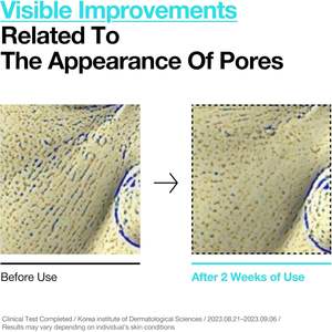 Anua Bha 2 Tonique Exfoliant Doux 150 ml Pour Tous Types de Peau avec Céramides et Acide Salicylique - Product Image 5