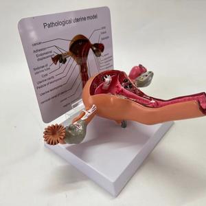Modelo de Patología del Útero Humano para Ciencias Médicas, Modelo de Enfermedad Órgánica, Modelo Antidrogas - Product Image 2