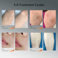 ICE CUBE Commercial Diode Laser 1200W 4 Wavelengths (755/808/940/1064nm) Hair Removal & Skin Rejuvenation Beauty Epilator