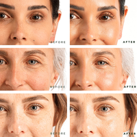 Sérum 5 en 1 Anti-âge Sérum rajeunissant avec niacinamide Astaxanthine Sérum Vitamines E Traitement éclaircissant