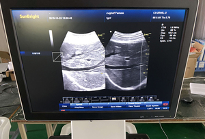 Système d'échographie Doppler couleur numérique complet CE JM-908A sur chariot, idéal pour des diagnostics complets, y compris abdominaux - Product Image 6