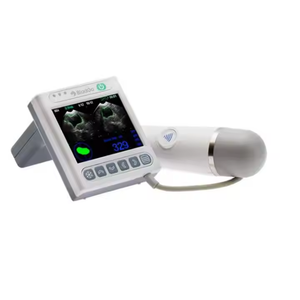 Escáner de Vejiga Portátil y Duradero con Pantalla LCD a Color de 3.5', Tiempo de Escaneo Más Rápido, Medidor de Volumen de Vejiga, Urología Veterinaria - Product Image 3