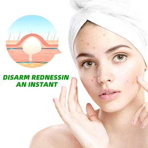 Bellezza biologica sbiancamento notte viso Anti Acne e brufolo sbiancamento Acne crema di rimozione per il viso - Product Image 5